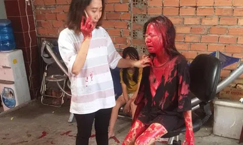 Cô gái 21 tuổi bị tạt sơn khắp người